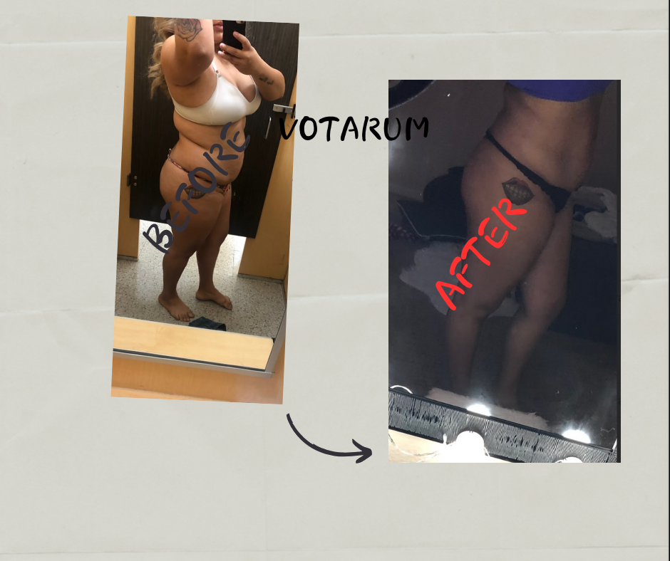 Before After 5