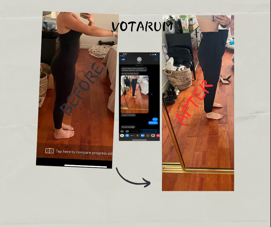 Before After 11