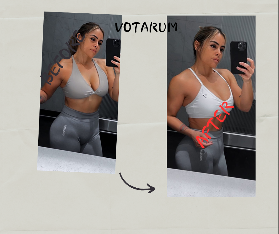 Before After 13
