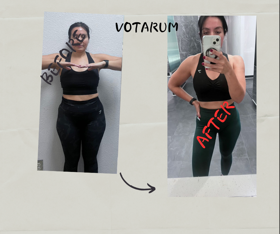 Before After 14