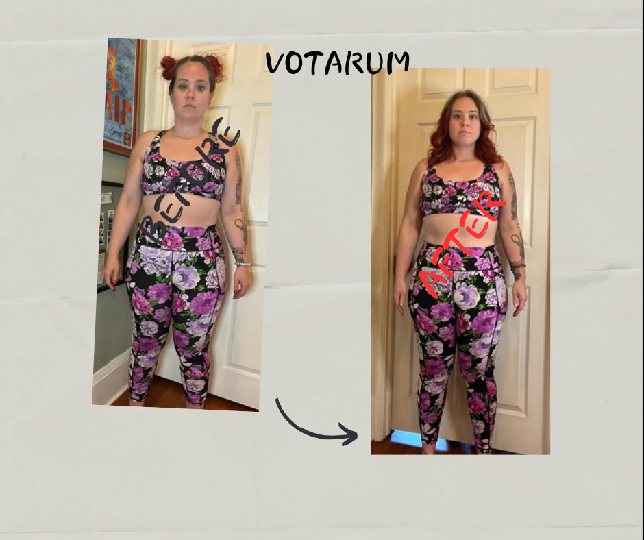 Before After 3